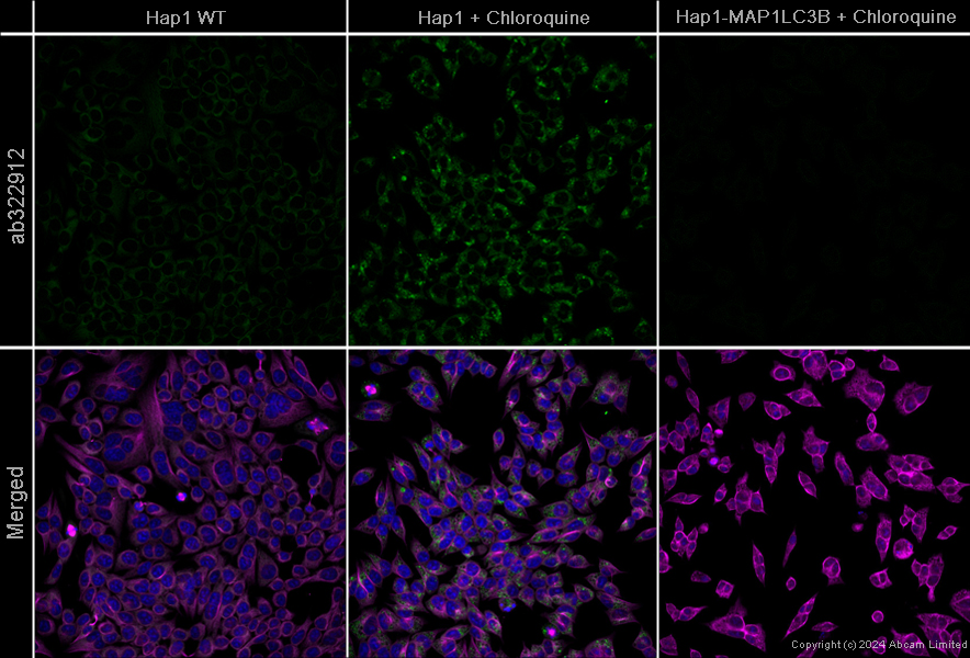 Immunocytochemistry/ Immunofluorescence - Anti-LC3B antibody [EPR18709] - Autophagosome Marker  – Chicken IgY (Chimeric) (AB322912), expandable thumbnail