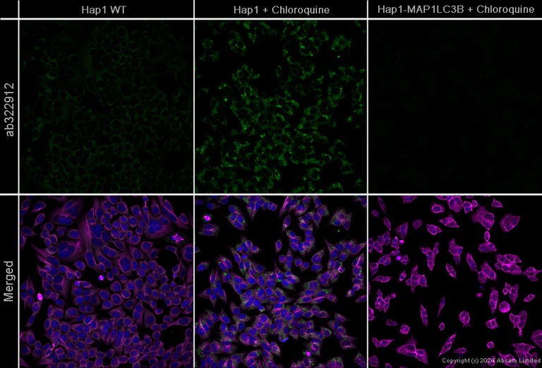 Immunocytochemistry/ Immunofluorescence - Anti-LC3B antibody [EPR18709] - Autophagosome Marker – Chicken IgY (Chimeric) (AB322912)
