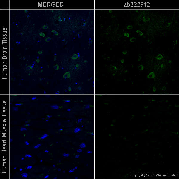 Immunohistochemistry (Formalin/PFA-fixed paraffin-embedded sections) - Anti-LC3B antibody [EPR18709] - Autophagosome Marker  – Chicken IgY (Chimeric) (AB322912), expandable thumbnail