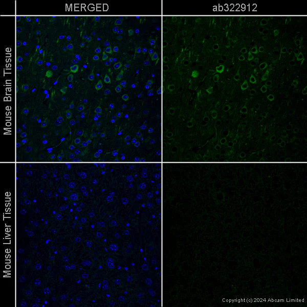Immunohistochemistry (Formalin/PFA-fixed paraffin-embedded sections) - Anti-LC3B antibody [EPR18709] - Autophagosome Marker – Chicken IgY (Chimeric) (AB322912)