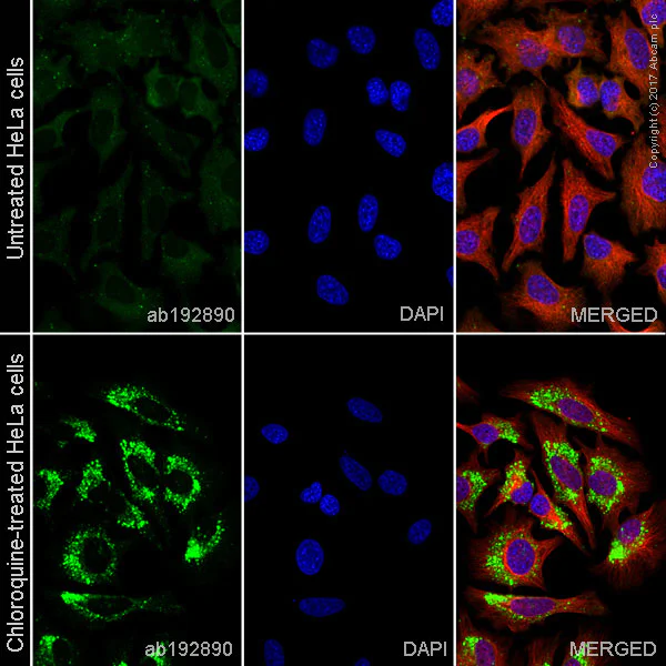 Immunocytochemistry/ Immunofluorescence - Anti-LC3B antibody [EPR18709] - BSA and Azide free (AB221794)