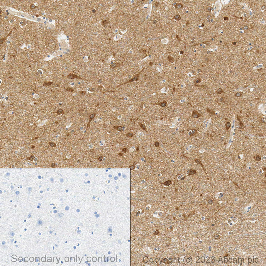 Immunohistochemistry (Formalin/PFA-fixed paraffin-embedded sections) - Anti-LC3B antibody [EPR18709] - BSA and Azide free (ab221794), expandable thumbnail
