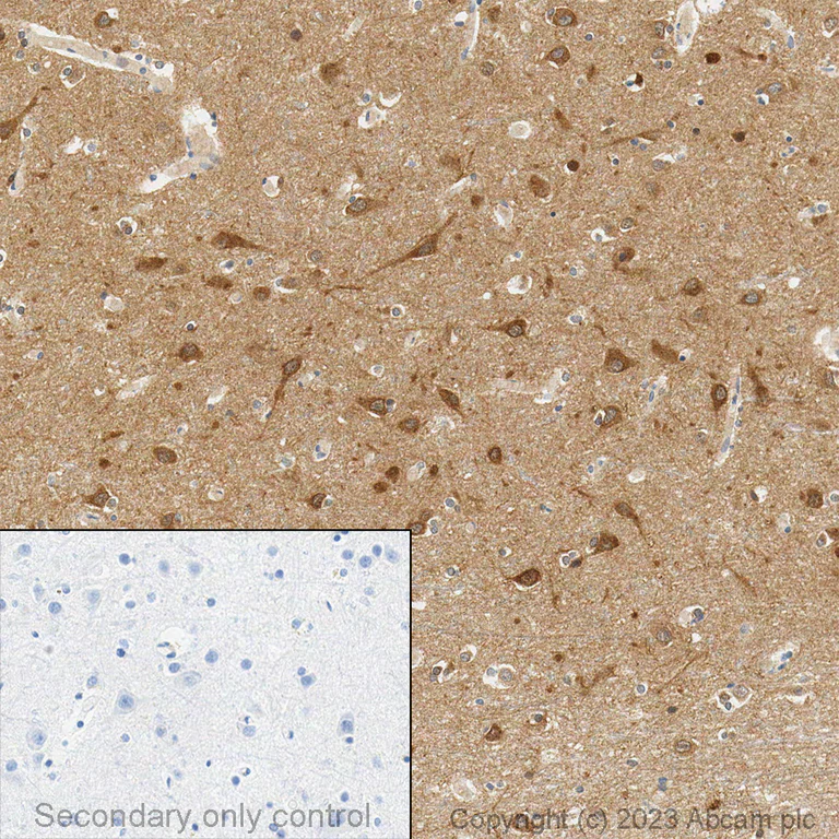 Immunohistochemistry (Formalin/PFA-fixed paraffin-embedded sections) - Anti-LC3B antibody [EPR18709] - BSA and Azide free (AB221794)
