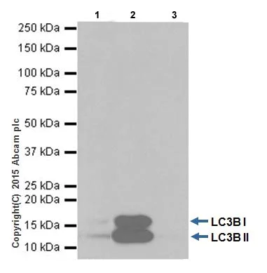 Immunoprecipitation - Anti-LC3B antibody [EPR18709] - BSA and Azide free (AB221794)