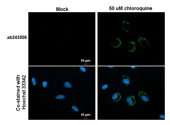 Immunocytochemistry/ Immunofluorescence - Anti-LC3B antibody [GT3612] (AB243506)