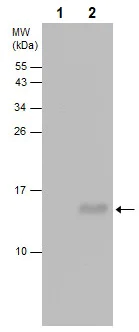 Western blot - Anti-LC3B antibody [GT3612] (AB243506)