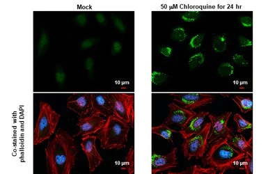 Immunocytochemistry/ Immunofluorescence - Anti-LC3B antibody - N-terminal (AB229327)
