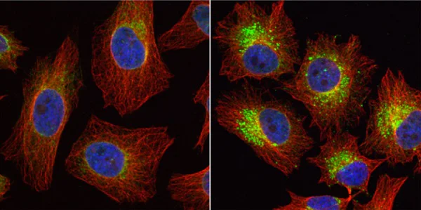 Immunocytochemistry/ Immunofluorescence - Anti-LC3B antibody - N-terminal (AB229327)