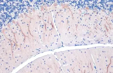 Immunohistochemistry (Formalin/PFA-fixed paraffin-embedded sections) - Anti-LC3B antibody - N-terminal (AB229327)