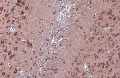 Immunohistochemistry (Formalin/PFA-fixed paraffin-embedded sections) - Anti-LC3B antibody - N-terminal (AB229327)