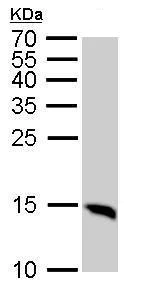 Western blot - Anti-LC3B antibody - N-terminal (AB229327)