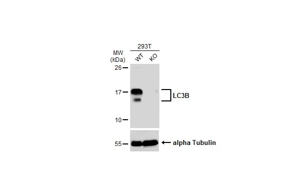 Western blot - Anti-LC3B antibody - N-terminal (AB229327)