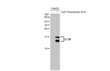 Western blot - Anti-LC3B antibody - N-terminal (AB229327)
