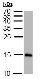 Western blot - Anti-LC3B antibody - N-terminal (AB229327)