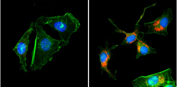 Immunocytochemistry/ Immunofluorescence - Anti-LC3B antibody [RM293] (AB222776), expandable thumbnail