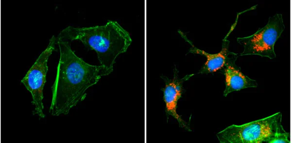 Immunocytochemistry/ Immunofluorescence - Anti-LC3B antibody [RM293] (AB222776)