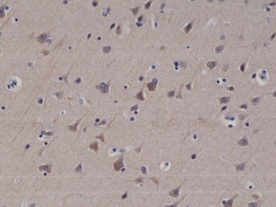 Immunohistochemistry (Formalin/PFA-fixed paraffin-embedded sections) - Anti-LC3B antibody [RM293] (AB222776), expandable thumbnail