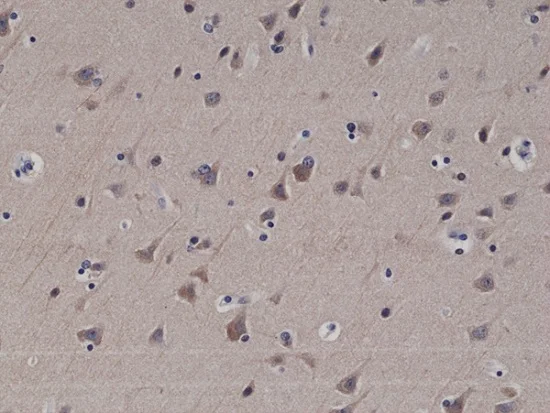Immunohistochemistry (Formalin/PFA-fixed paraffin-embedded sections) - Anti-LC3B antibody [RM293] (AB222776)
