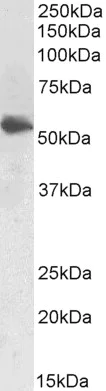 Western blot - Anti-LCAT antibody (AB223574)