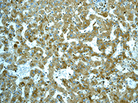 Immunohistochemistry (Formalin/PFA-fixed paraffin-embedded sections) - Anti-LCAT antibody [EPR1383(2)] (AB109417), expandable thumbnail