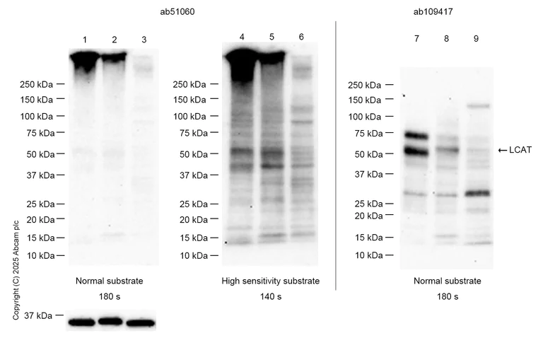 Western blot - Anti-LCAT antibody [EPR1383(2)] (AB109417)