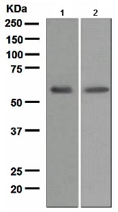 Western blot - Anti-LCAT antibody [EPR1383(2)] - BSA and Azide free (AB175019)