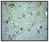 Immunohistochemistry (Formalin/PFA-fixed paraffin-embedded sections) - Anti-LCAT antibody [EPR1384Y] - Low endotoxin, Azide free (AB227112)