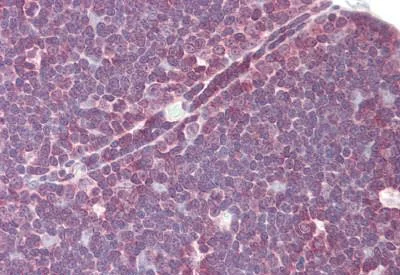 Immunohistochemistry (Formalin/PFA-fixed paraffin-embedded sections) - Anti-Lck antibody (AB189933)