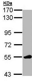 Western blot - Anti-Lck antibody (AB189933), expandable thumbnail