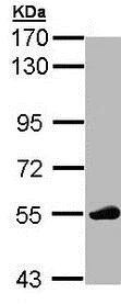 Western blot - Anti-Lck antibody (AB189933)