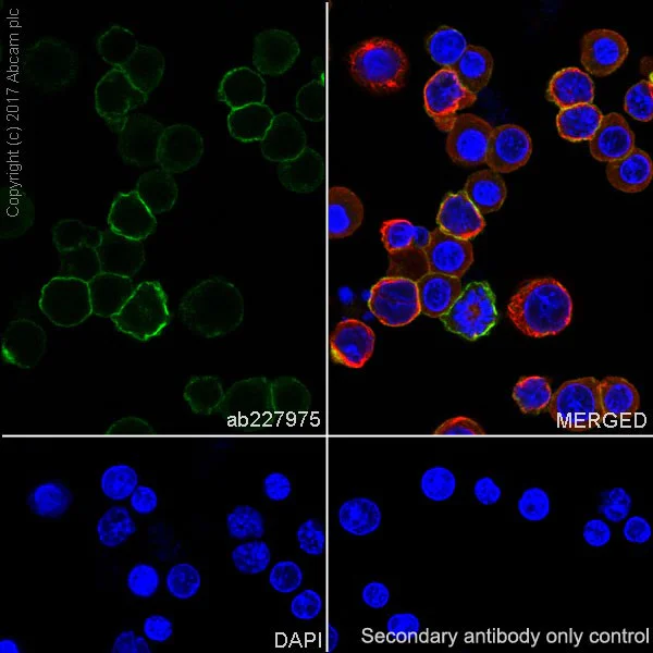 Immunocytochemistry/ Immunofluorescence - Anti-Lck antibody [EPR20798-107] (AB227975)