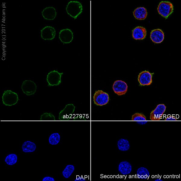 Immunocytochemistry/ Immunofluorescence - Anti-Lck antibody [EPR20798-107] (ab227975), expandable thumbnail