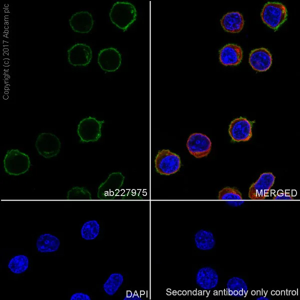 Immunocytochemistry/ Immunofluorescence - Anti-Lck antibody [EPR20798-107] (AB227975)