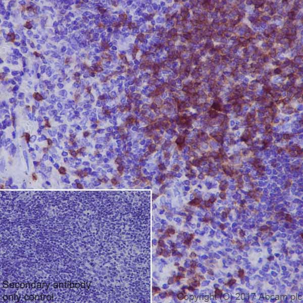 Immunohistochemistry (Formalin/PFA-fixed paraffin-embedded sections) - Anti-Lck antibody [EPR20798-107] (ab227975), expandable thumbnail