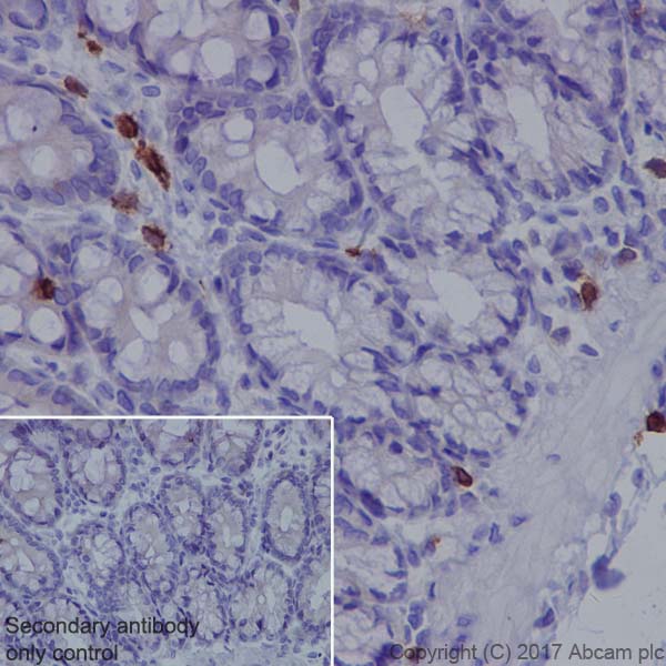 Immunohistochemistry (Formalin/PFA-fixed paraffin-embedded sections) - Anti-Lck antibody [EPR20798-107] (AB227975), expandable thumbnail