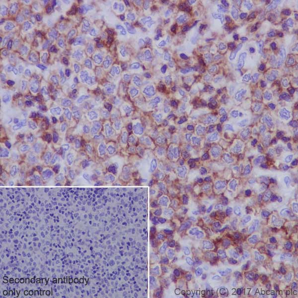 Immunohistochemistry (Formalin/PFA-fixed paraffin-embedded sections) - Anti-Lck antibody [EPR20798-107] (ab227975), expandable thumbnail