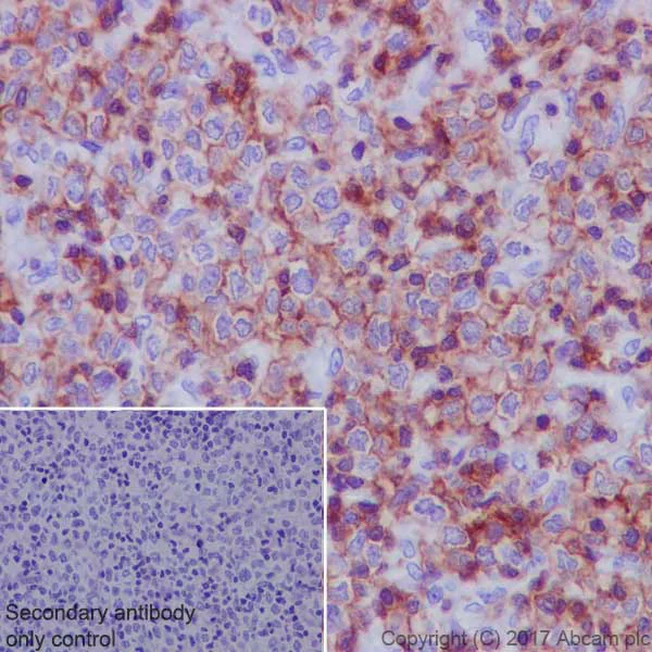 Immunohistochemistry (Formalin/PFA-fixed paraffin-embedded sections) - Anti-Lck antibody [EPR20798-107] (AB227975)