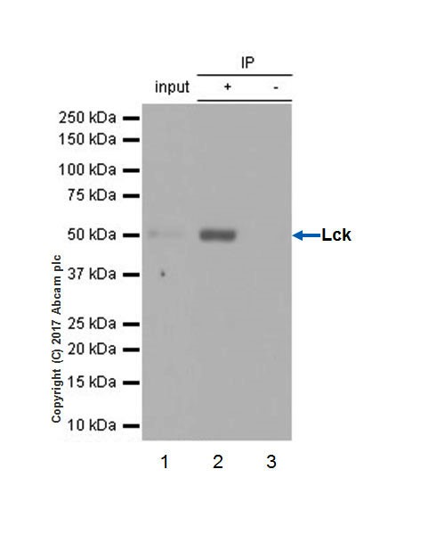 Immunoprecipitation - Anti-Lck antibody [EPR20798-107] (AB227975), expandable thumbnail