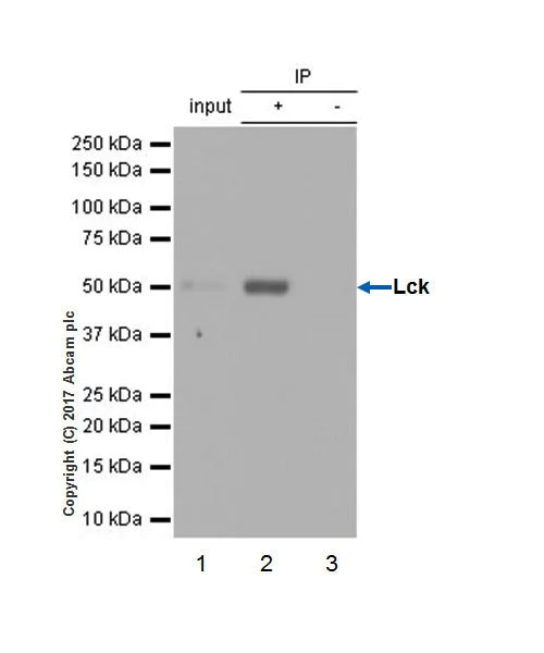 Immunoprecipitation - Anti-Lck antibody [EPR20798-107] (AB227975)