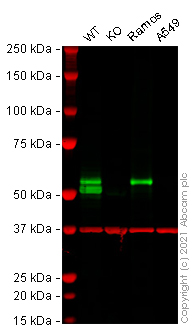 Western blot - Anti-Lck antibody [EPR20798-107] (AB227975), expandable thumbnail