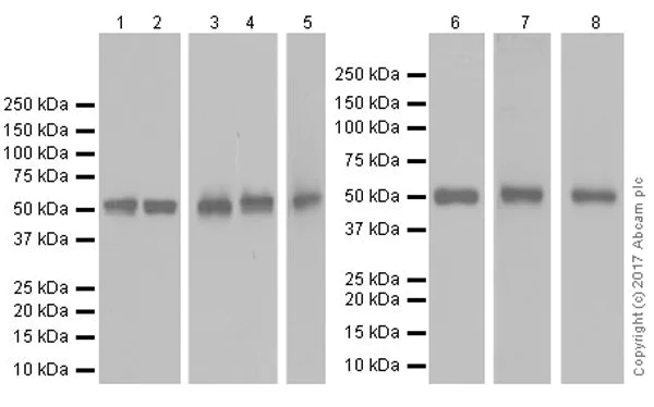 Western blot - Anti-Lck antibody [EPR20798-107] (AB227975)