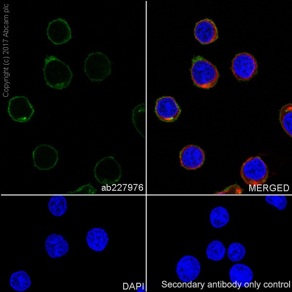 Immunocytochemistry/ Immunofluorescence - Anti-Lck antibody [EPR20798-55] (AB227976)