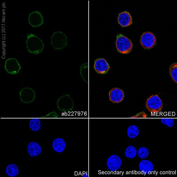 Immunocytochemistry/ Immunofluorescence - Anti-Lck antibody [EPR20798-55] (AB227976)