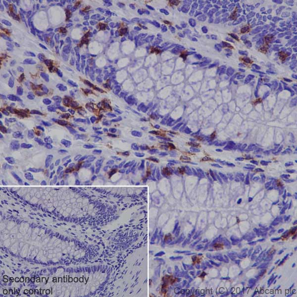 Immunohistochemistry (Formalin/PFA-fixed paraffin-embedded sections) - Anti-Lck antibody [EPR20798-55] (AB227976)