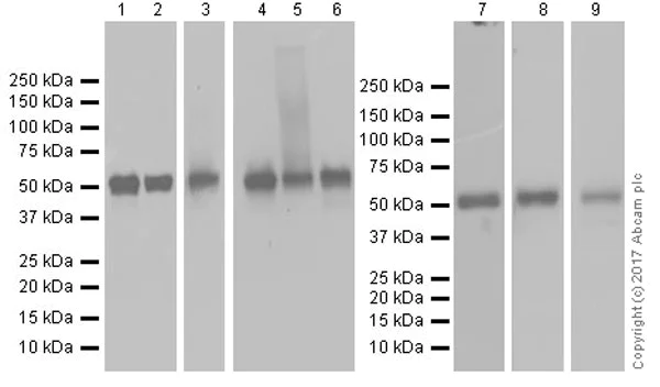 Western blot - Anti-Lck antibody [EPR20798-55] (AB227976)