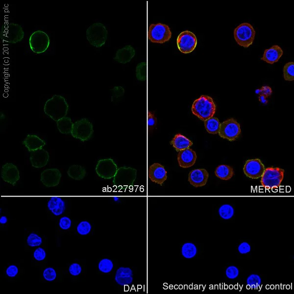 Immunocytochemistry/ Immunofluorescence - Anti-Lck antibody [EPR20798-55] - BSA and Azide free (AB229380)