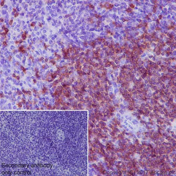Immunohistochemistry (Formalin/PFA-fixed paraffin-embedded sections) - Anti-Lck antibody [EPR20798-55] - BSA and Azide free (AB229380)