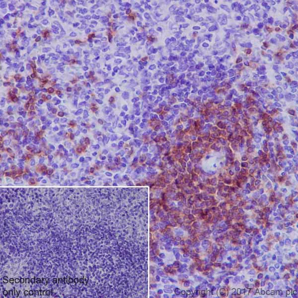 Immunohistochemistry (Formalin/PFA-fixed paraffin-embedded sections) - Anti-Lck antibody [EPR20798-55] - BSA and Azide free (AB229380)