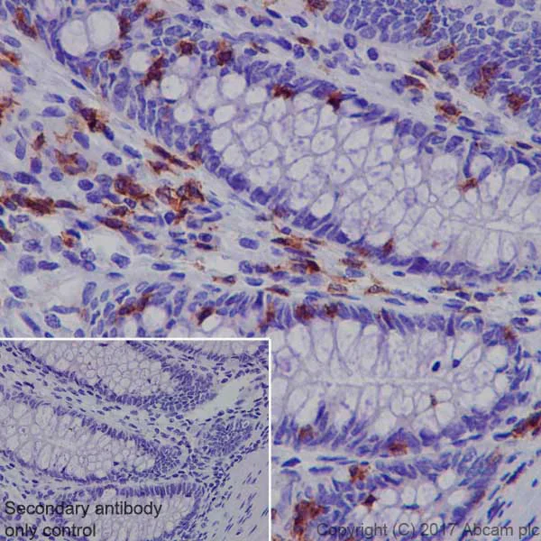 Immunohistochemistry (Formalin/PFA-fixed paraffin-embedded sections) - Anti-Lck antibody [EPR20798-55] - BSA and Azide free (AB229380)