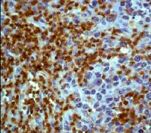 Immunohistochemistry (Formalin/PFA-fixed paraffin-embedded sections) - Anti-Lck antibody [Y123] (AB32149)